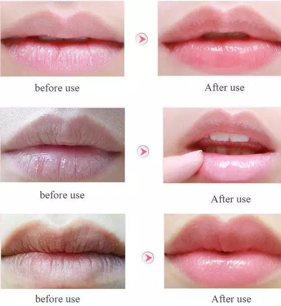 10pcs hydrogel lip mask set